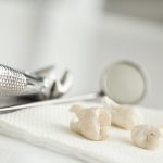 wisdom tooth