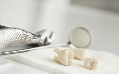 Prepare for Wisdom Teeth Removal Surgery
