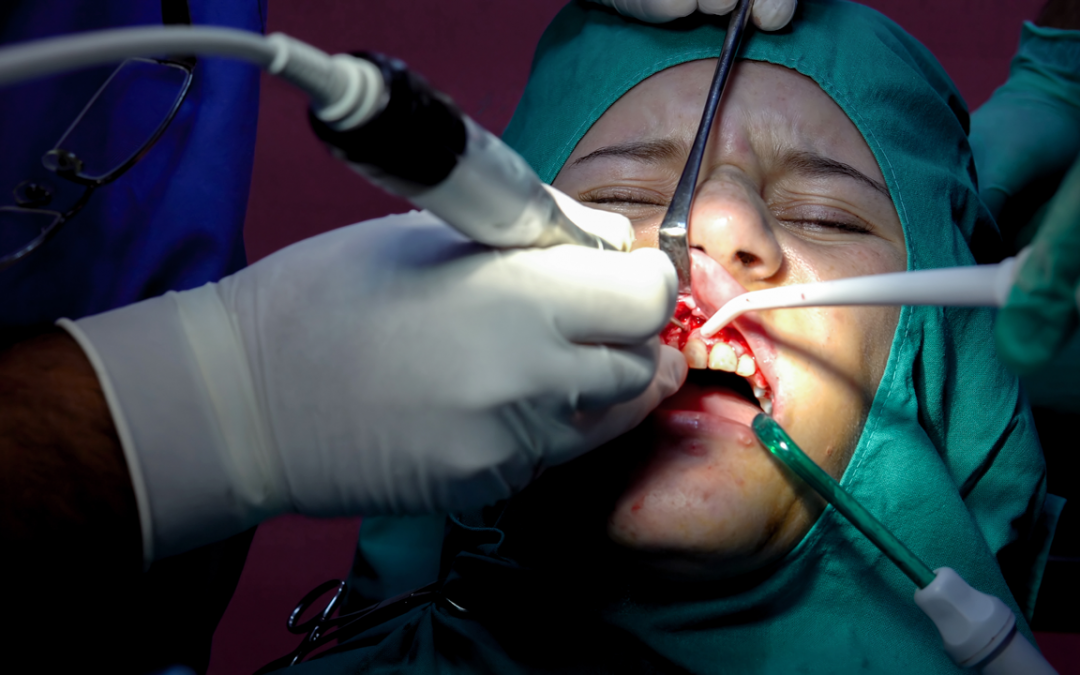 Tips On Procedures After Teeth Injury Through Orthodontic