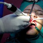 Orthodontic procedure