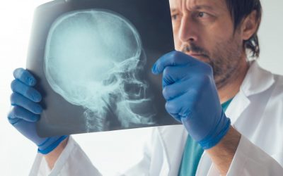 Information About Fractured Jaw Treatment
