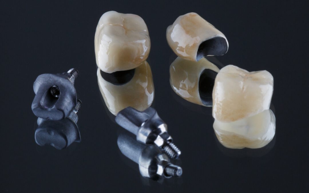 What are the types of dental crown