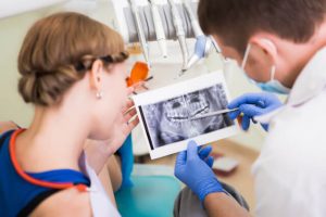 dental implants problems