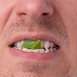 foods that promote healing after oral surgery