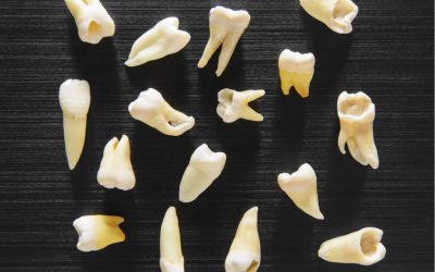 How to Pull a Tooth