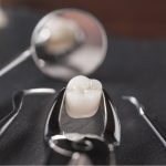 how to care for a tooth extraction