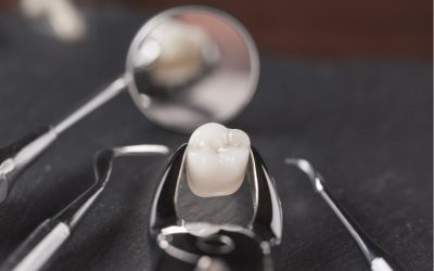 How to Care for a Tooth Extraction