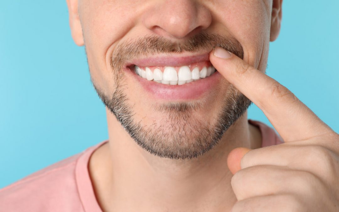 How to straighten tooth enamel