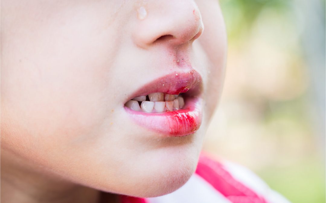 When to Make an Emergency Dental Visit