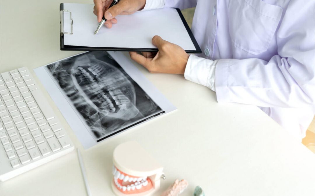What Is The Role Of Reconstructive Orthopedics In Dentistry? (Before Surgery)