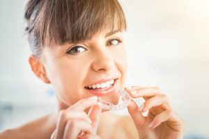 Invisalign Go treatment plan