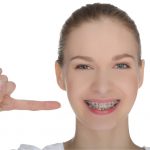 woman with metallic braces