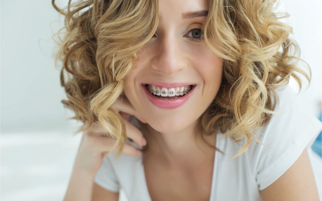 Comprehensive Orthodontic Treatment: Different Devices and Benefits