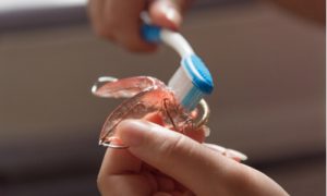 invisalign maintenance