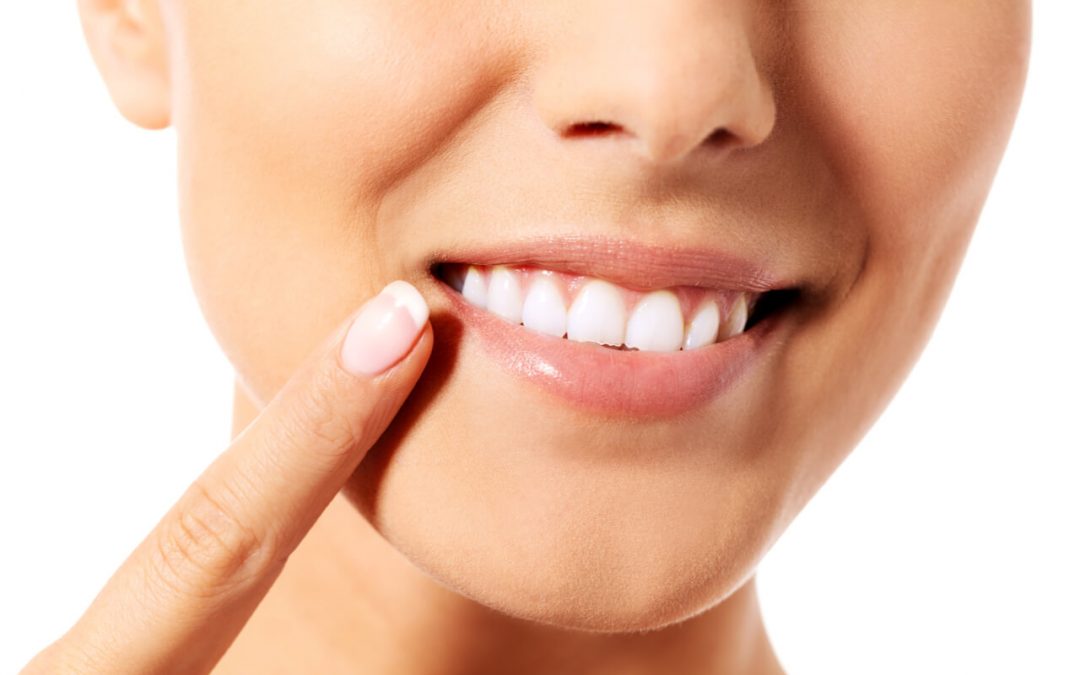 Crown Overlay: Used On Damaged Yet Functional Teeth