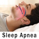 Wondering if sleep apnea is genetic