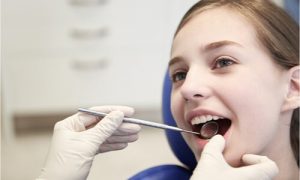 Palate expander