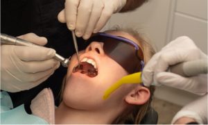 palate expander adjustment
