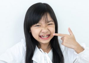 Palate expander on a young girl