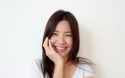 How Old Do You Have to Be to Get Braces?