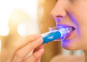 Drawbacks of whitening strips