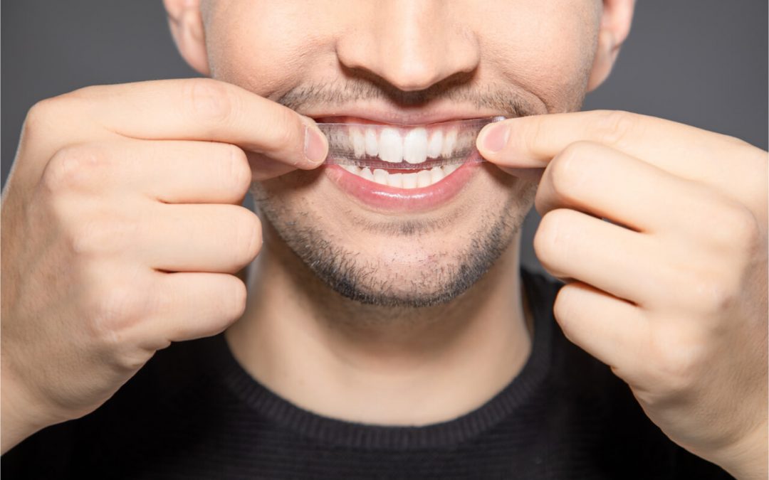 The Best Whitening Strips: Our Top Picks