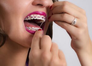 Why is flossing important