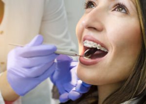 Braces and cosmetic dentistry
