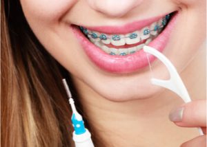 HJow to floss with superfloss