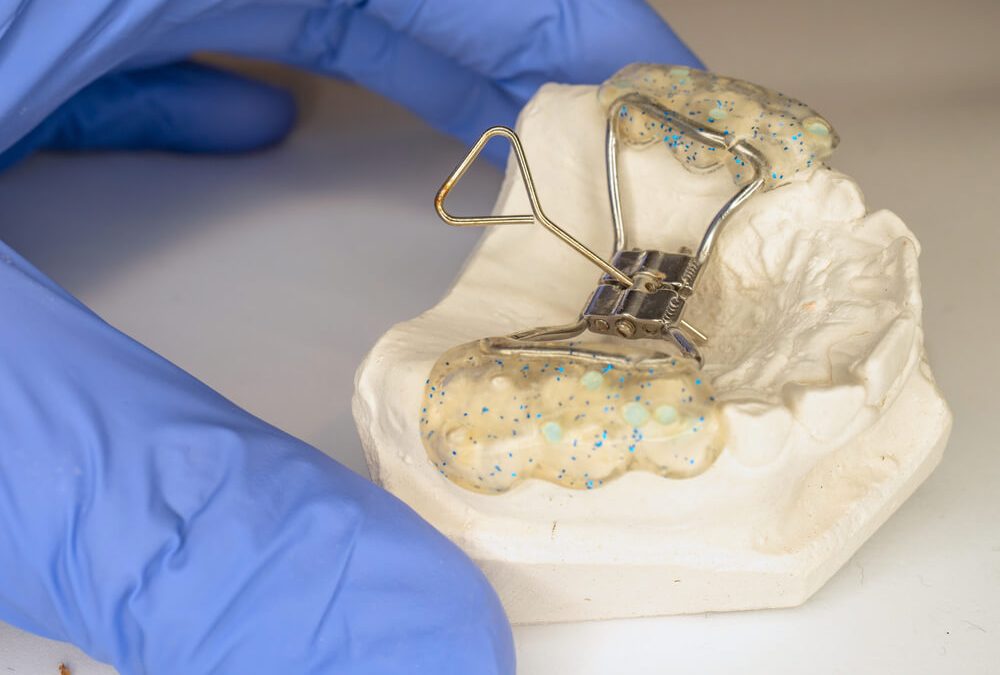 How much does a Palate Expander cost?