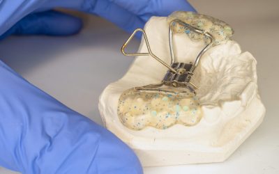 How much does a Palate Expander cost?