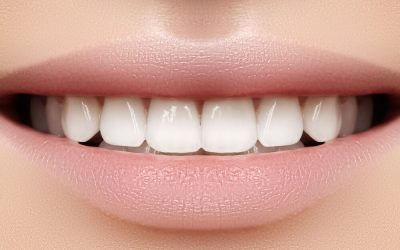 Why Sharp Canine Teeth are Attractive