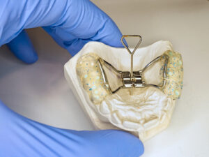 orthopedic maxillary expansion