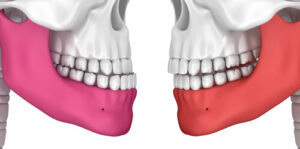 attractive slight overbite