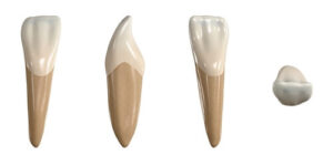pointy teeth peg teeth