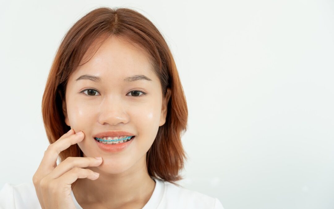 How to Fix Impacted Canine Teeth Without Braces: Exploring Effective Alternatives
