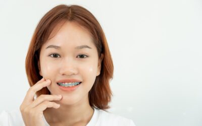How to Fix Impacted Canine Teeth Without Braces: Exploring Effective Alternatives